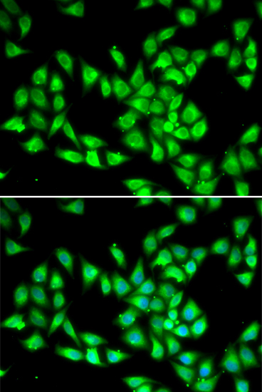 PCMT1 Rabbit polyclonal antibody