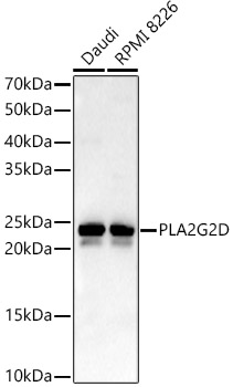 PLA2G2D Rabbit polyclonal antibody