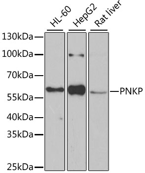 PNKP Rabbit polyclonal antibody