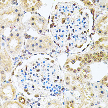 PNKP Rabbit polyclonal antibody