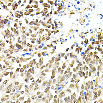 PNKP Rabbit polyclonal antibody