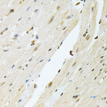 PNKP Rabbit polyclonal antibody