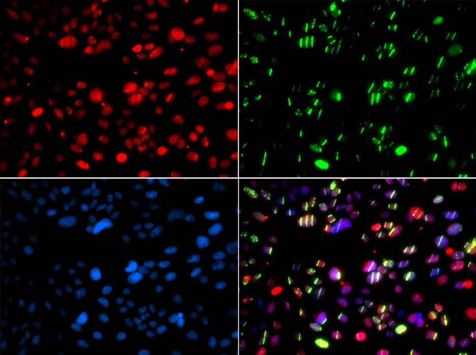 PNKP Rabbit polyclonal antibody