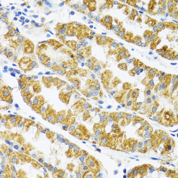 POLG2 Rabbit polyclonal antibody