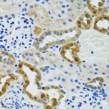 POLG2 Rabbit polyclonal antibody