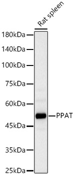 PPAT Rabbit polyclonal antibody