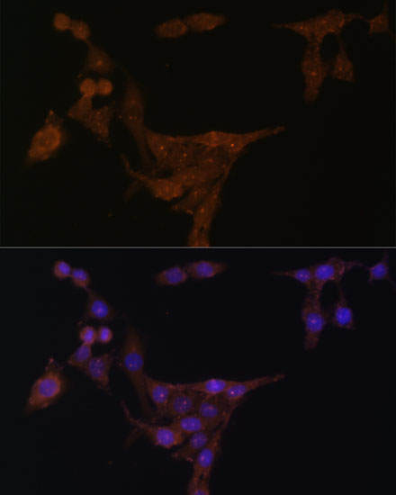 PPAT Rabbit polyclonal antibody