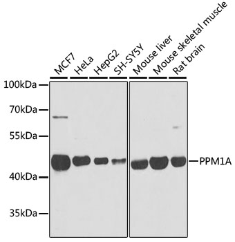 PPM1A Rabbit polyclonal antibody