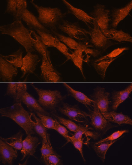 PPM1A Rabbit polyclonal antibody