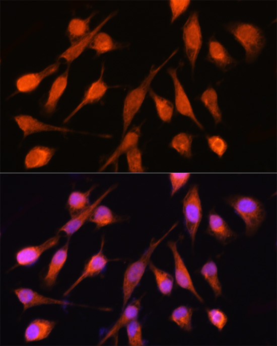 PPM1A Rabbit polyclonal antibody