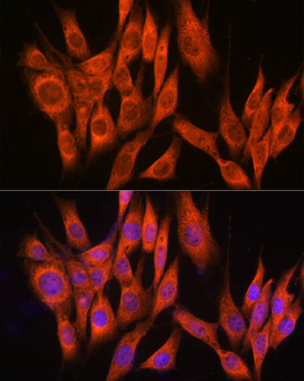 PPM1A Rabbit polyclonal antibody