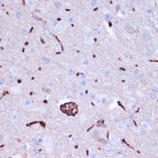 PROK2 Rabbit polyclonal antibody