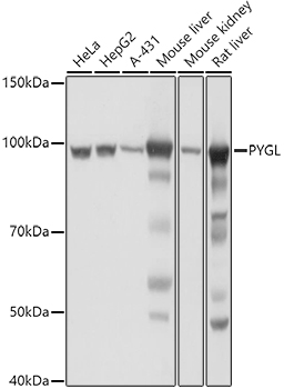 PYGL Rabbit polyclonal antibody