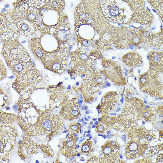 PYGL Rabbit polyclonal antibody