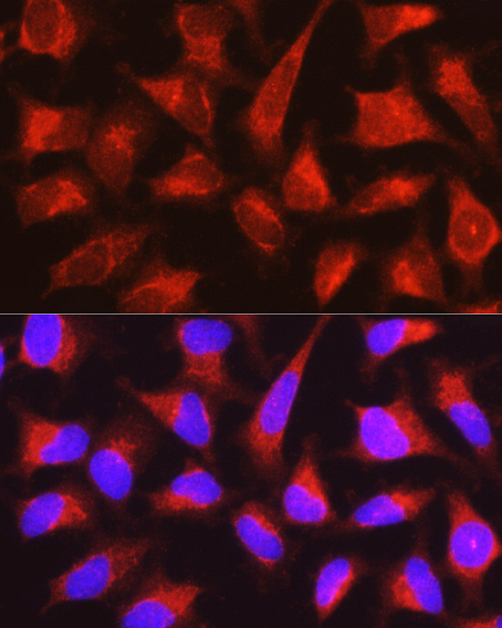 PYGL Rabbit polyclonal antibody