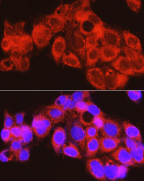 PYGL Rabbit polyclonal antibody