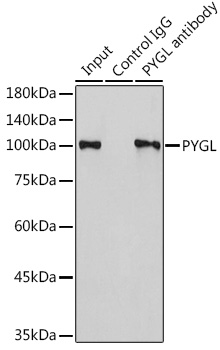 PYGL Rabbit polyclonal antibody