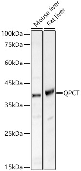 QPCT Rabbit polyclonal antibody