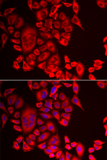 QPCT Rabbit polyclonal antibody