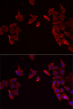 RAMP3 Rabbit polyclonal antibody
