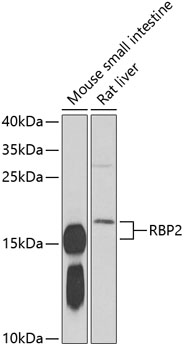 RBP2 Rabbit polyclonal antibody