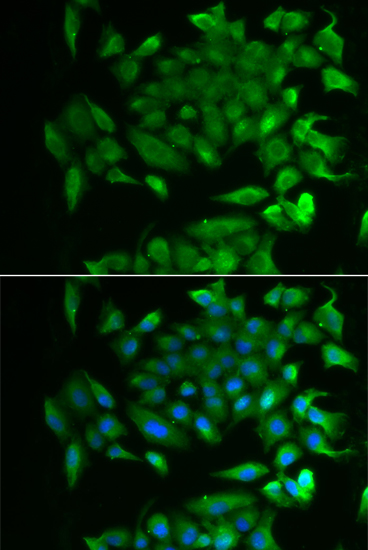 RBP2 Rabbit polyclonal antibody