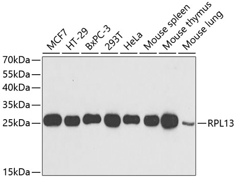 RPL13 Rabbit polyclonal antibody