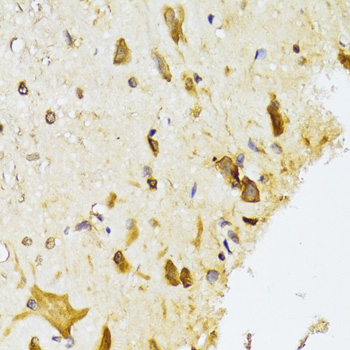 RPL13 Rabbit polyclonal antibody