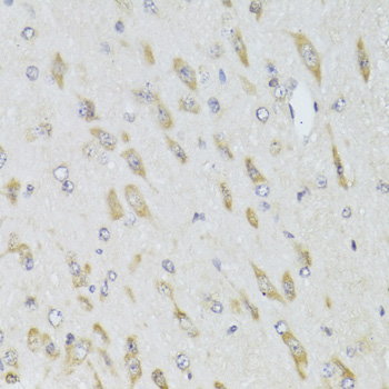 RPL13 Rabbit polyclonal antibody