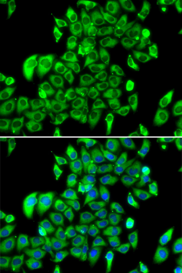 RPL13 Rabbit polyclonal antibody