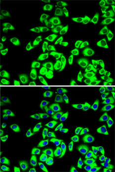 RPL14 Rabbit polyclonal antibody