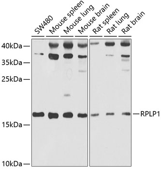 RPLP1 Rabbit polyclonal antibody