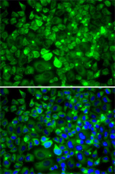 RPLP1 Rabbit polyclonal antibody