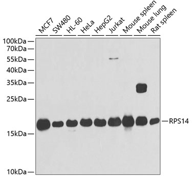 RPS14 Rabbit polyclonal antibody