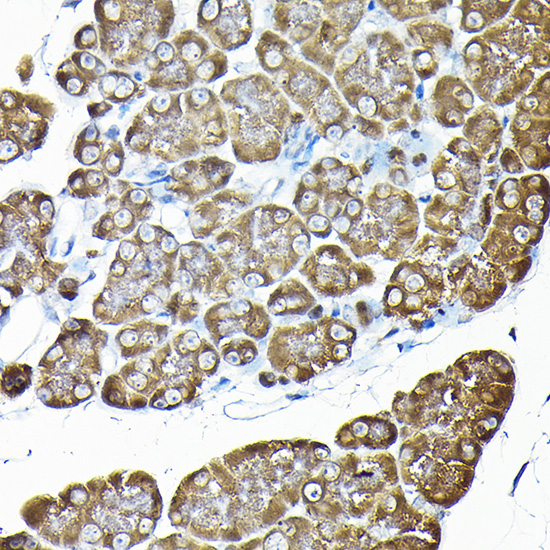 RPS14 Rabbit polyclonal antibody