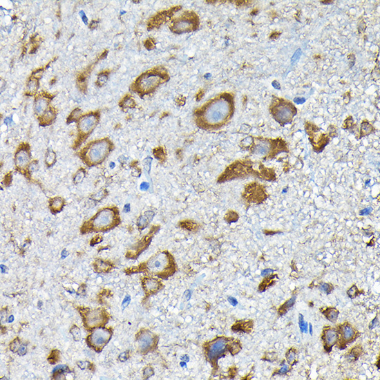 RPS14 Rabbit polyclonal antibody