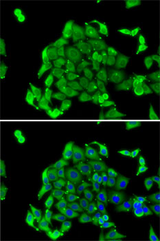RPS14 Rabbit polyclonal antibody