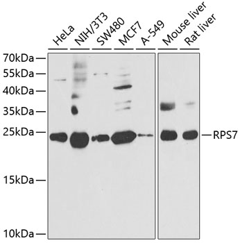 RPS7 Rabbit polyclonal antibody