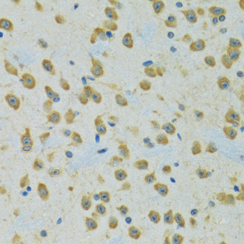 RPS7 Rabbit polyclonal antibody