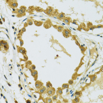 RPS7 Rabbit polyclonal antibody