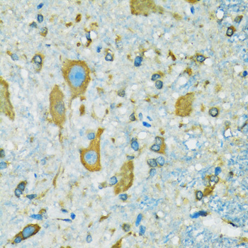 RPS7 Rabbit polyclonal antibody