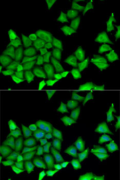 RPS7 Rabbit polyclonal antibody
