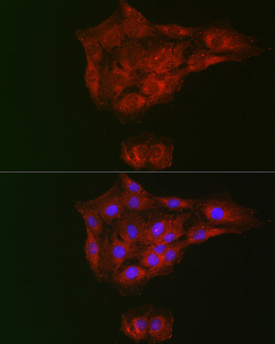 RTKN Rabbit polyclonal antibody