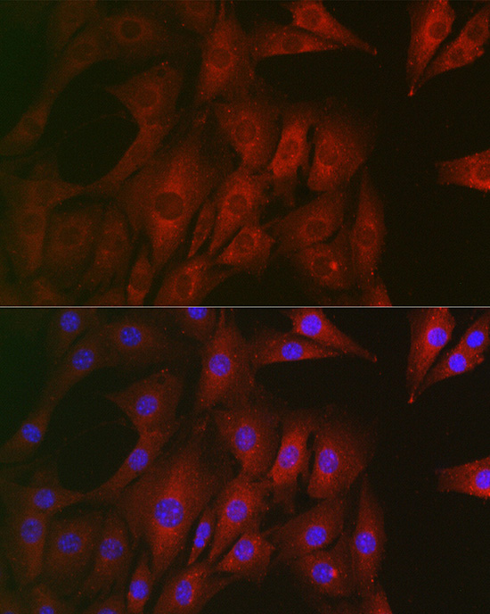 RTKN Rabbit polyclonal antibody