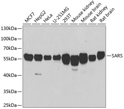 SARS Rabbit polyclonal antibody