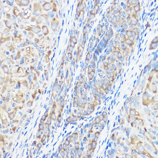 SARS Rabbit polyclonal antibody