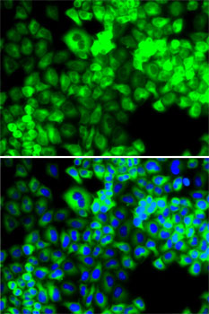 SARS Rabbit polyclonal antibody
