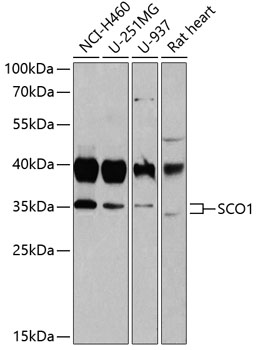 SCO1 Rabbit polyclonal antibody
