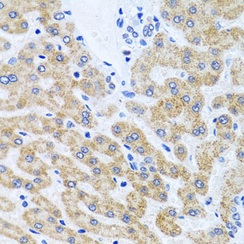 SCO1 Rabbit polyclonal antibody