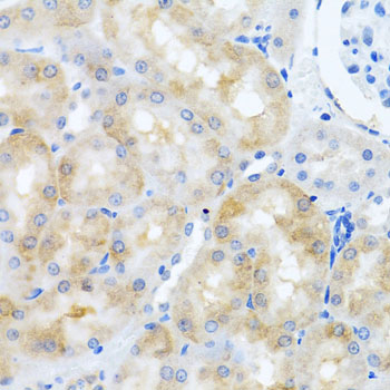 SCO1 Rabbit polyclonal antibody